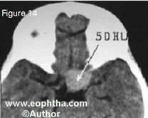 e8.14