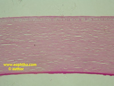 fuchs endothelial dystrophy
