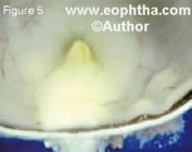 e8.5