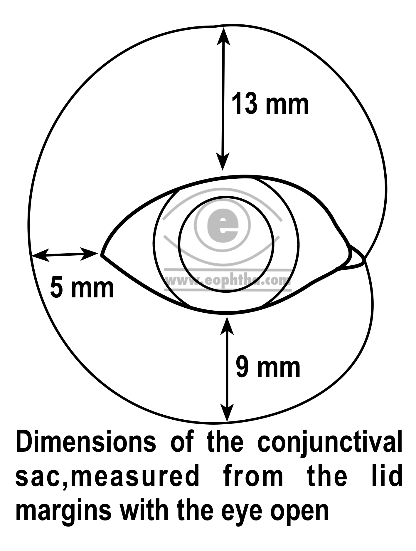 fornix