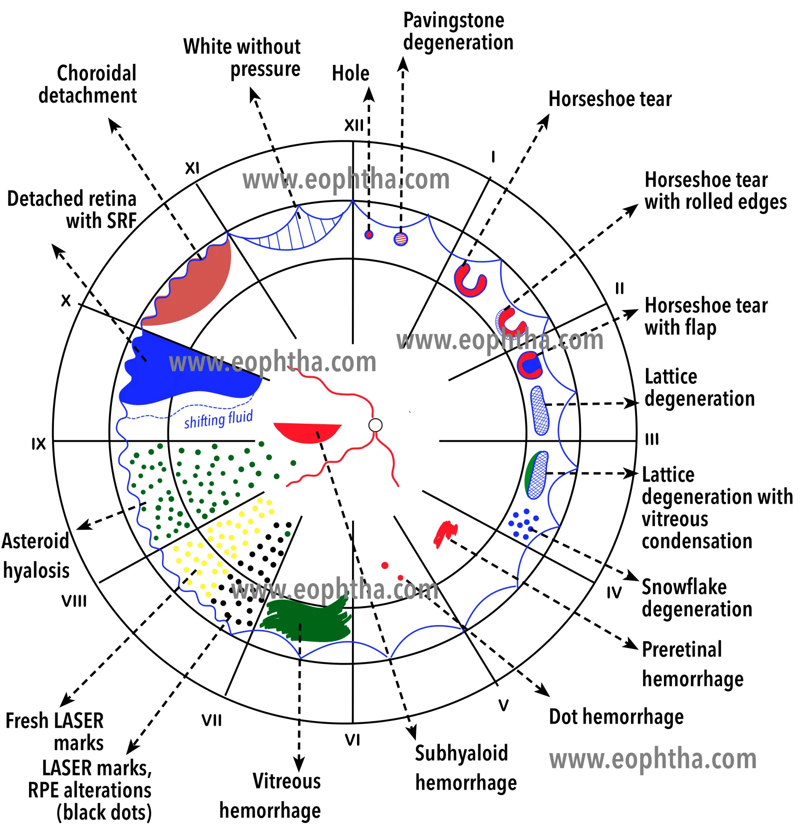 Fundus_drawing2