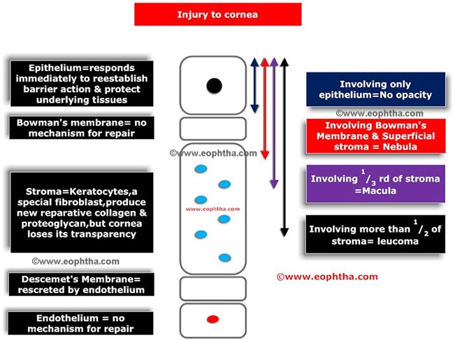 Corneal injury