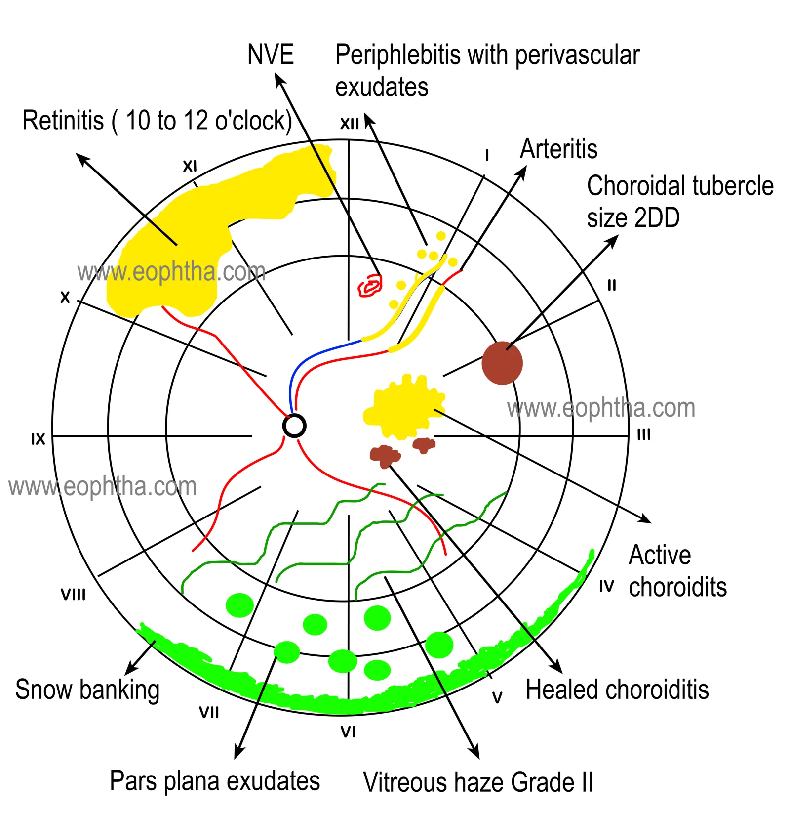 Fundus Drawing
