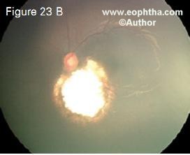 e8.23b