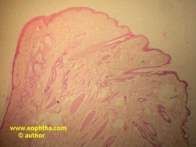 eyelid
