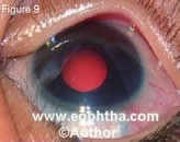 e8.9